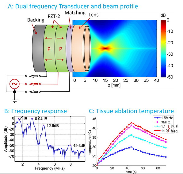 High intensity focused ultrasound Dr. Xiaoning Jiang Research Group